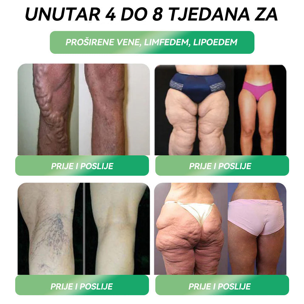 ✅ Preporučuje više od 100 000 ljudi | službena trgovina | 𝐒𝐓𝐃𝐄𝐈® 👩⚕️👩⚕️ 𝐆𝐋𝐏-𝟏 𝐌𝐫š𝐚𝐯𝐥𝐣𝐞𝐧𝐣𝐞 𝐎𝐫𝐚𝐥𝐧𝐚 𝐨𝐭𝐨𝐩𝐢𝐧𝐚 - Pretilost, kardiovaskularne bolesti, dijabetes, apneja u snu, problemi sa zglobovima i još mnogo toga